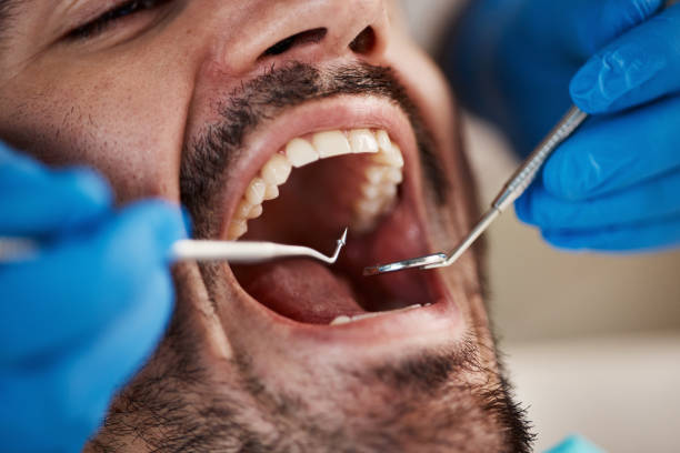 Best Knocked-Out Tooth Emergency  in Old Tappan, NJ